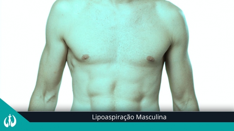 Cirurgia de Lipoaspiração Abdominal Masculina