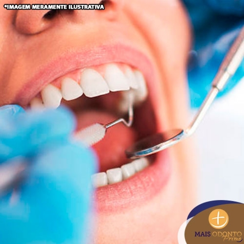 Cirurgia Dentária Estética