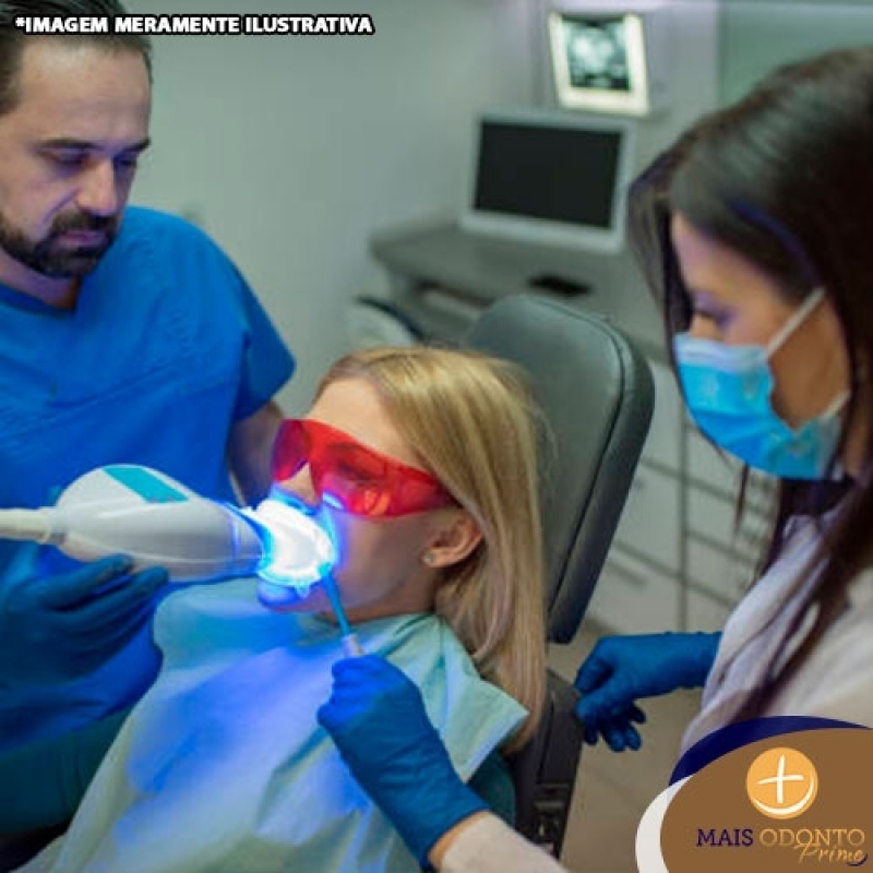 Clareamento Dental Laser