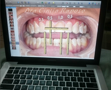 Clínica de Estética para Dentes