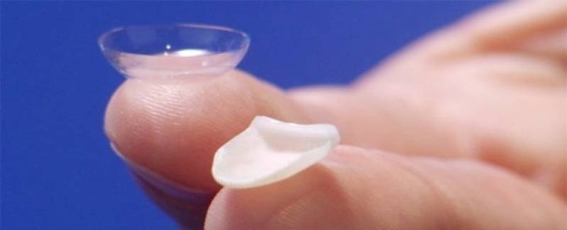 Clínica de Estética para Implante Dentário