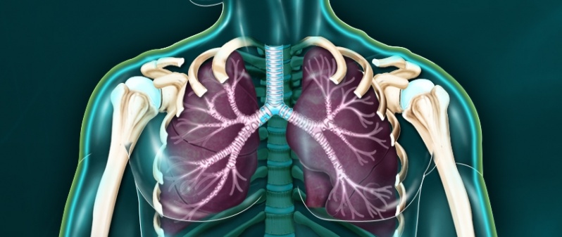 Clínica de Pneumologia para Tratar Enfisema Pulmonar