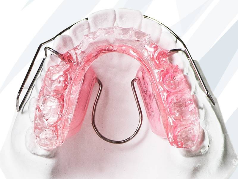 Clínica para Colocar Implante Dentário