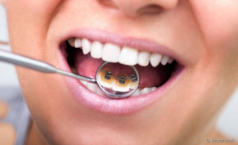 Clínica para Restauração Estética Dental