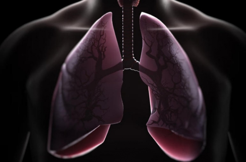 Consulta Pneumologista para Tratar Embolia Pulmonar
