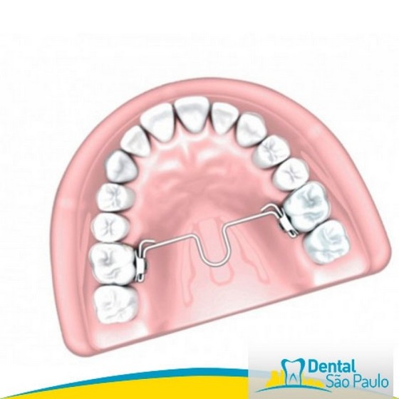Dental Ortodontia Produtos Aditek