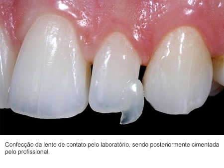 Dentista em Taboão da Serra