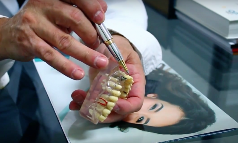 Estética Dentária com Facetas