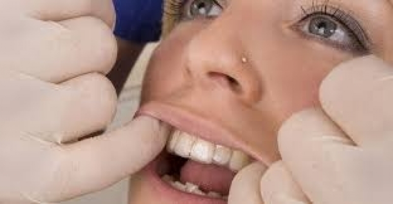 Invisalign Dentista