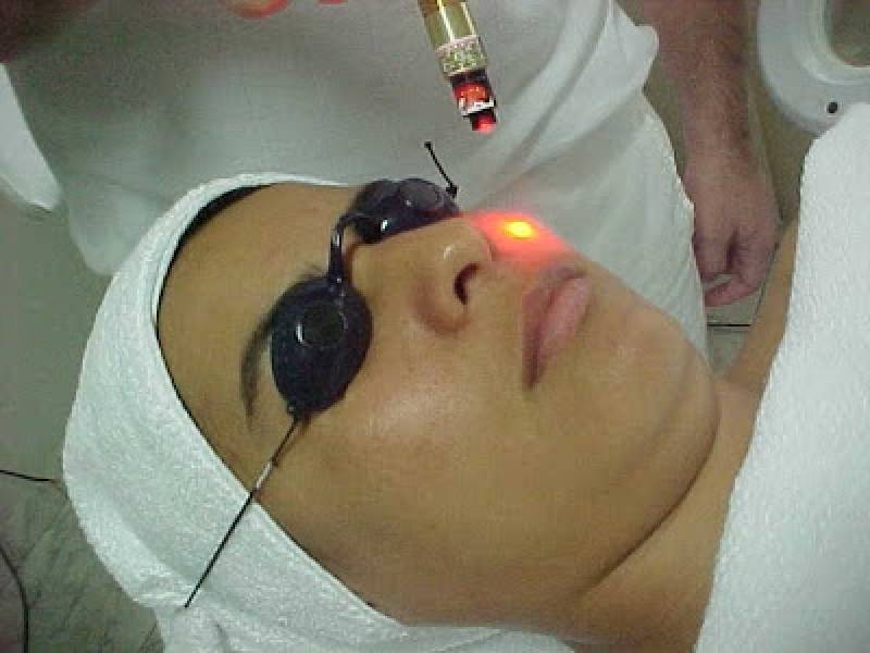 Plástica Biofotônica para Tratamento a Laser