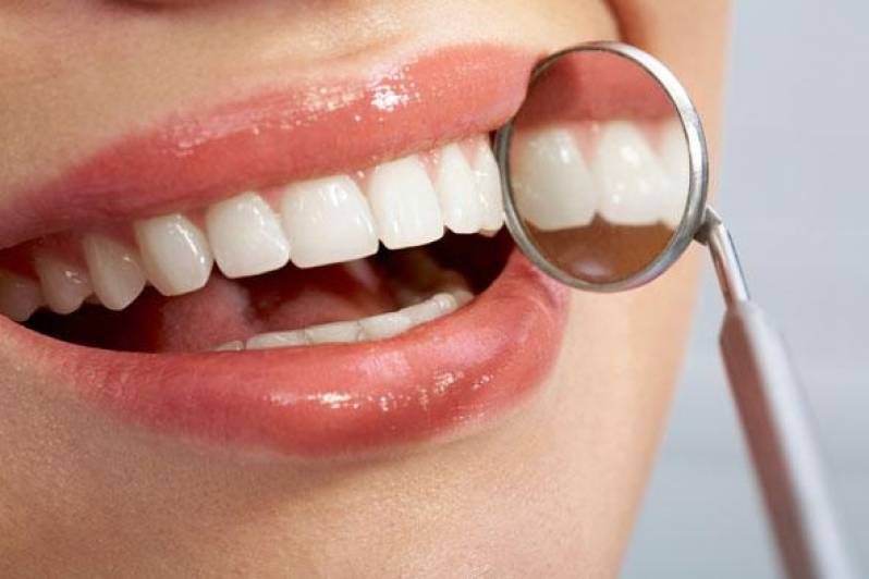 Prótese Dentária Estética