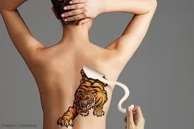 Remover Tatuagens