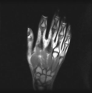 Ressonância Magnética Particular das Mãos