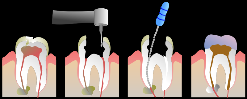 Tratamento Dentário em Taboão da Serra