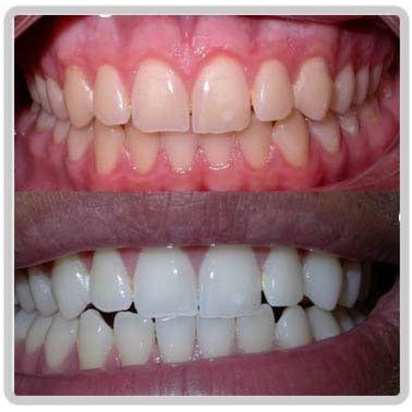 Ortodontia - APIO